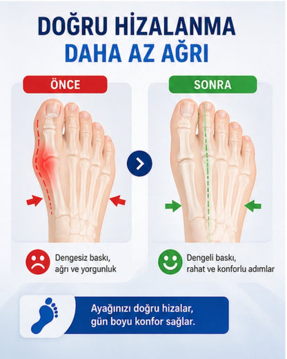 Ortonira Halluks Valgus Düzeltici – Ayak Baş Parmak Destek Ateli