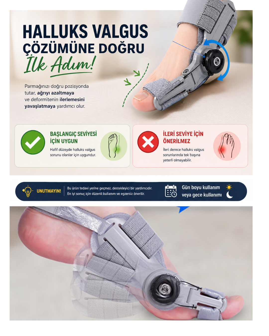 Ortonira Halluks Valgus Düzeltici – Ayak Baş Parmak Destek Ateli